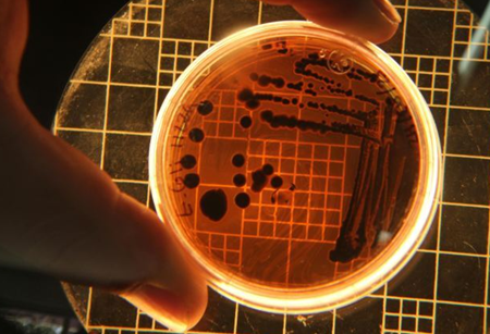 Precision microbial fermentation: The time is now for potatoes